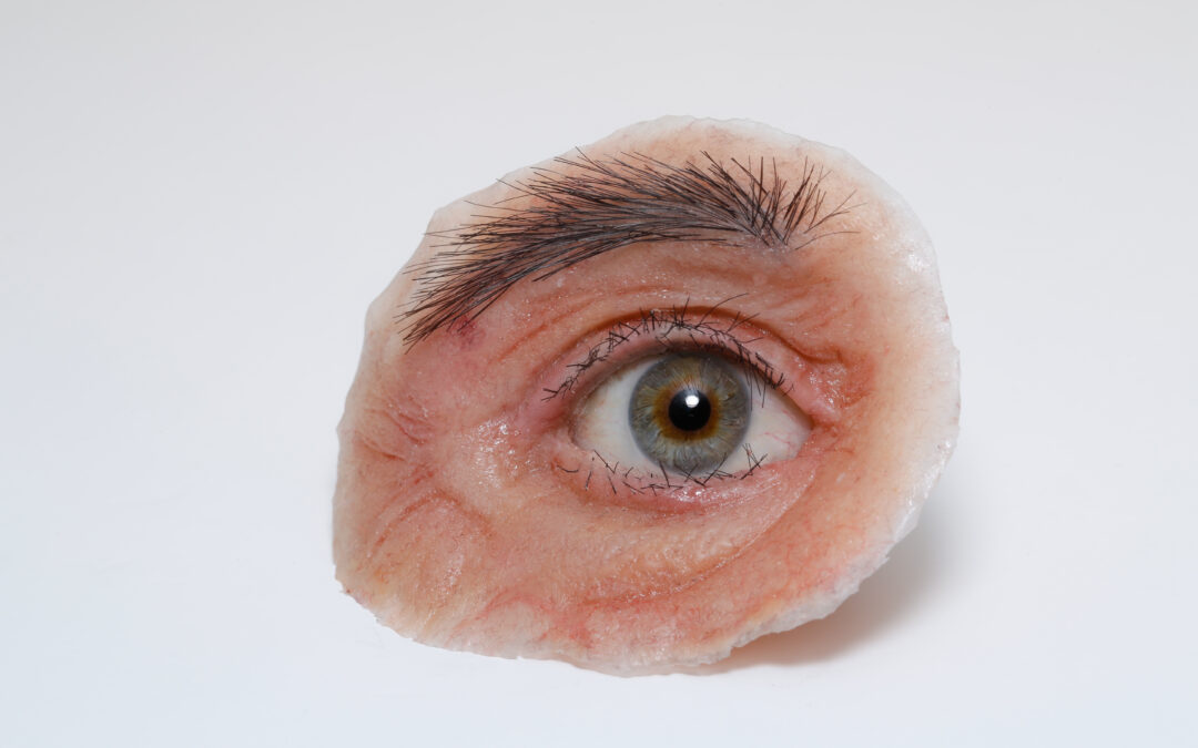 Wie unterscheiden sich Augenprothesen zu Augenephitesen?